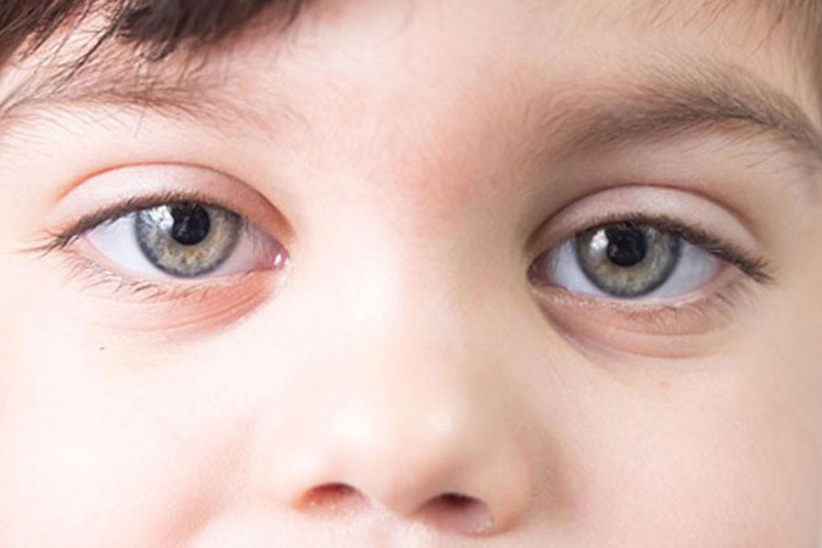Çocuk ve Gençlerde EMDR Terapisi Nedir?